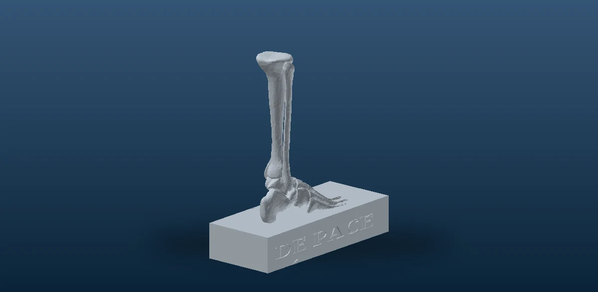 Vista estática de un modelo 3D utilizado como apoyo visual en planificación ortopédica.